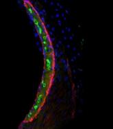 Research explains why cisplatin causes hearing loss