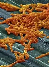 Drug gets orphan designation for CDI