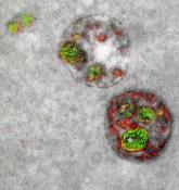 Team develops multicolor electron microscopy