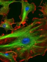 Endothelial cells seem to support lymphoma growth