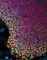 Research paves way for new SCID treatment