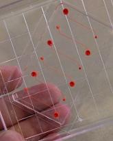 Device could be used to monitor antiplatelet therapy