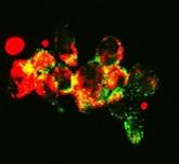 Combating drug resistance in FLT3-mutated AML