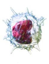 Inflammation, coagulation may contribute to CM pathogenesis