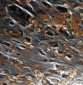 Platelet mimics provide targeted drug delivery