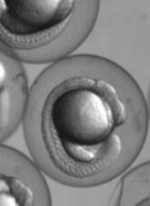 Study provides insights on gene linked to lymphoma