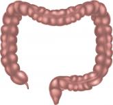 IBD classification needs an upgrade