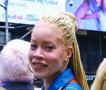 Ms. Diandra Forrest, a model and advocate with albinism