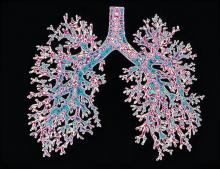 Computer-enhanced image of a resin cast of the airways in the lungs.