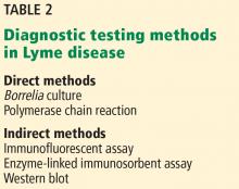 Table 2. Diagnostic testing methods in Lyme disease.