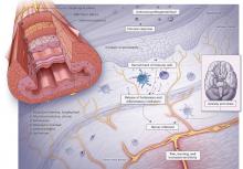 Figure 1. Conceptual pathophysiologic basis of functional heartburn.