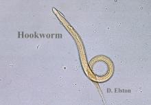 FIGURE 1. Microscopic image of hookworm larvae.