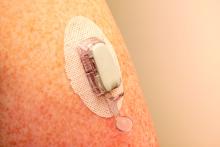 Patient's arm with a continuous glucose monitor