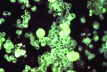 Cytomegalovirus (CMV) particles glowing through the use of an immunofluorescent technique, magnified at 25X.