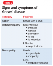 Signs and symptoms of Graves’ disease