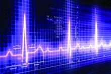 Image of an electrocardiogram