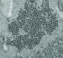 An electron micrograph of a thin section of EV-D68, showing the numerous, spherical viral particles.