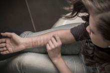 A girl scratches her right arm, which has cut marks