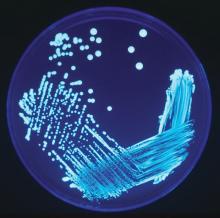 Legionella sp. colonies growing on an en:agar plate and illuminated using ultraviolet light to increase contrast.