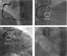 Results of angiography.