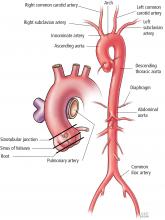 The sections of the aortic root and its position in the aorta.