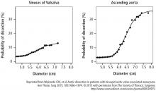  Risk of dissection in patients with bicuspid aortic valve increases more steeply in valves with a diameter larger than 5.5 cm.