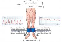 The patient’s ankle-brachial index and pulse-volume recordings.