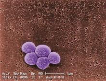 Magnified 20,000X, this colorized scanning electron micrograph depicts a grouping of MRSA bacteria.