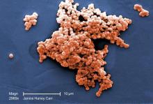 Group B Streptococcus | MDedge Pediatrics