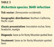 Rickettsia species 364D infection