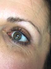 Eyebrow before microblading.