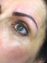 Eyebrow in the same patient, post-microblading