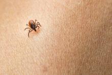 Tick parasite crawling on human skin.