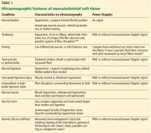 Ultrasonographic features of musculoskeletal soft tissue