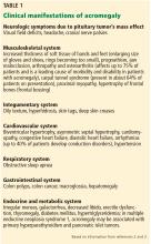 Clinical manifestations of acromegaly