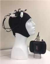 The TRPMS cap placed on a dummy head showing the attachment of microstimulators to scalp locations overlying Broca's and Wernicke's areas. At right is the stimulator console device controller box.