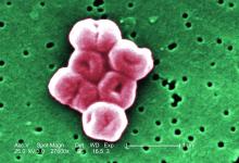 A cluster of Acinetobacter baumannii bacteria.