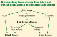 Distinguishing Crohn disease from intestinal Behçet disease based on endoscopic appearance