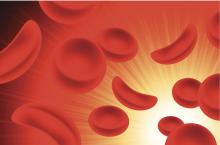 sickle cells