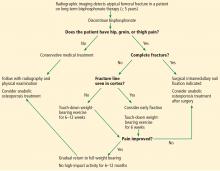 An algorithm for treating bisphosphonate-associated atypical femoral fracture.