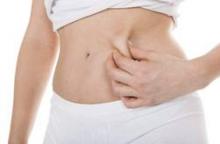 Adipose hyperplasia is a rare side effect of cryolipolysis.