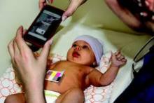 The BiliCam app and color-calibration card are used to screen for jaundice in this newborn.