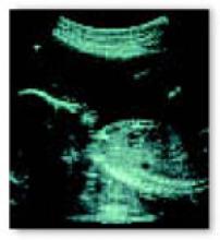 ●OMR Obstetric ultrasound with no maternal evaluation | MDedge