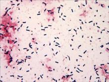 Hemorrhagic Bullous Lesions Due to Bacillus cereus in a Cirrhotic ...