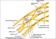 A summary of the new ACOG report on neonatal brachial plexus palsy ...