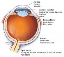 Common causes of nonocular vision loss