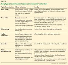 Key physical examination features in monocular vission loss