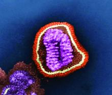 This negative-stained transmission electron micrograph depicts the ultrastructural details of an influenza virus particle, or a virion.