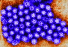 This transmission electron micrograph reveals norovirus virions or virus particles.