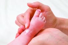 Mother applying ointment to red scaly patch on baby's foot